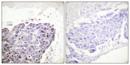 WB - GR Polyclonal Antibody AP70228